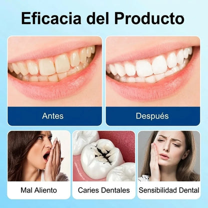 HydroDent™ Elimina la Placa Dental y Blanquea tus Dientes